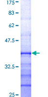 ab152666 on a 12.5% SDS-PAGE stained with Coomassie Blue.