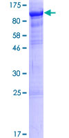 ab161557 on a 12.5% SDS-PAGE stained with Coomassie Blue.