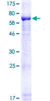 ab153014 on a 12.5% SDS-PAGE stained with Coomassie Blue.