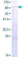 ab164230 on a 12.5% SDS-PAGE stained with Coomassie Blue.