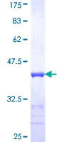 ab164231 on a 12.5% SDS-PAGE stained with Coomassie Blue.