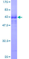 ab164501 on a 12.5% SDS-PAGE stained with Coomassie Blue.