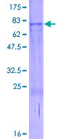 ab161721 on a 12.5% SDS-PAGE stained with Coomassie Blue.