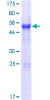 ab164979 on a 12.5% SDS-PAGE stained with Coomassie Blue.