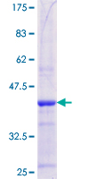 ab162520 on a 12.5% SDS-PAGE stained with Coomassie Blue.