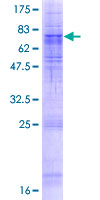 ab162999 on a 12.5% SDS-PAGE stained with Coomassie Blue.
