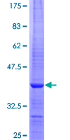 ab162157 on a 12.5% SDS-PAGE stained with Coomassie Blue.