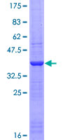ab153110 on a 12.5% SDS-PAGE stained with Coomassie Blue.