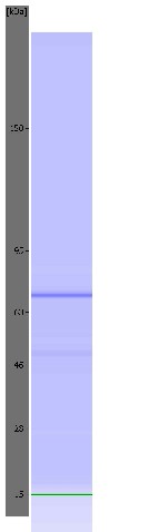 The image shows an electrophoretic assay performed using an Agilent 5100 ALP. In some images coloured control bands can be seen at 15 kDa (green) and/or 240 kDa (purple). The protein-specific band is blue.