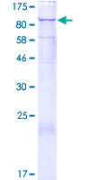 ab162275 on a 12.5% SDS-PAGE stained with Coomassie Blue.