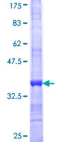 ab159475 on a 12.5% SDS-PAGE stained with Coomassie Blue.
