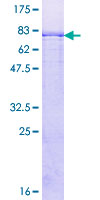 ab161067 on a 12.5% SDS-PAGE stained with Coomassie Blue.