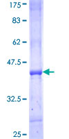 ab161068 on a 12.5% SDS-PAGE stained with Coomassie Blue.