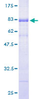 ab160267 on a 12.5% SDS-PAGE stained with Coomassie Blue.