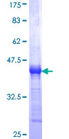 ab160269 on a 12.5% SDS-PAGE stained with Coomassie Blue.