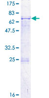 ab161580 on a 12.5% SDS-PAGE stained with Coomassie Blue.