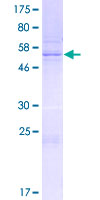 ab153321 on a 12.5% SDS-PAGE stained with Coomassie Blue.