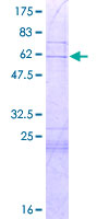 ab153571 on a 12.5% SDS-PAGE stained with Coomassie Blue.