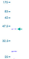 ab159493 on a 12.5% SDS-PAGE stained with Coomassie Blue.