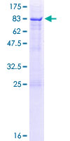 ab160026 on a 12.5% SDS-PAGE stained with Coomassie Blue.