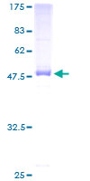 ab161230 on a 12.5% SDS-PAGE stained with Coomassie Blue.