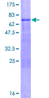 ab161677 on a 12.5% SDS-PAGE stained with Coomassie Blue.