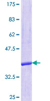 ab161678 on a 12.5% SDS-PAGE stained with Coomassie Blue.