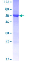 ab166189 on a 12.5% SDS-PAGE stained with Coomassie Blue.