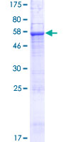 ab160344 on a 12.5% SDS-PAGE stained with Coomassie Blue.