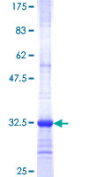 ab160345 on a 12.5% SDS-PAGE stained with Coomassie Blue.