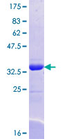 ab161162 on a 12.5% SDS-PAGE stained with Coomassie Blue.