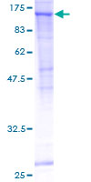 ab160588 on a 12.5% SDS-PAGE stained with Coomassie Blue.