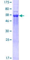 ab161845 on a 12.5% SDS-PAGE stained with Coomassie Blue.