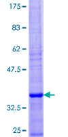 ab161213 on a 12.5% SDS-PAGE stained with Coomassie Blue.