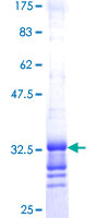 ab161214 on a 12.5% SDS-PAGE stained with Coomassie Blue.