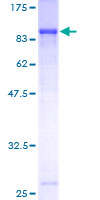 12.5% SDS-PAGE analysis of ab152353 stained with Coomassie Blue.