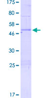 ab161132 on a 12.5% SDS-PAGE stained with Coomassie Blue.