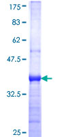 ab161483 on a 12.5% SDS-PAGE stained with Coomassie Blue.