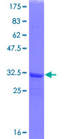 ab161480 on a 12.5% SDS-PAGE stained with Coomassie Blue.
