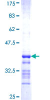 ab161481 on a 12.5% SDS-PAGE stained with Coomassie Blue.