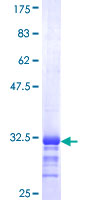 ab163690 on a 12.5% SDS-PAGE stained with Coomassie Blue.
