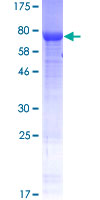 ab164417 on a 12.5% SDS-PAGE stained with Coomassie Blue.