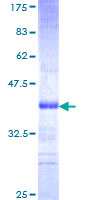 ab153092 on a 12.5% SDS-PAGE stained with Coomassie Blue.