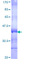 ab162889 on a 12.5% SDS-PAGE stained with Coomassie Blue.