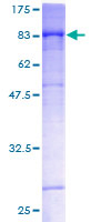 ab161030 on a 12.5% SDS-PAGE stained with Coomassie Blue.