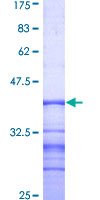 ab153091 on a 12.5% SDS-PAGE stained with Coomassie Blue.