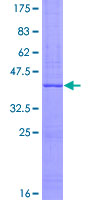 ab152943 on a 12.5% SDS-PAGE stained with Coomassie Blue.