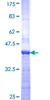 ab163538 on a 12.5% SDS-PAGE stained with Coomassie Blue.