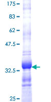ab160472 on a 12.5% SDS-PAGE stained with Coomassie Blue.