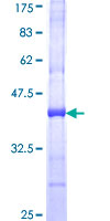 ab153009 on a 12.5% SDS-PAGE stained with Coomassie Blue.